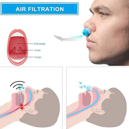 2 In 1 Anti Snoring And Air Purifier Nose Clip Anti Snoring Device (1 Pc With Plastic Case)